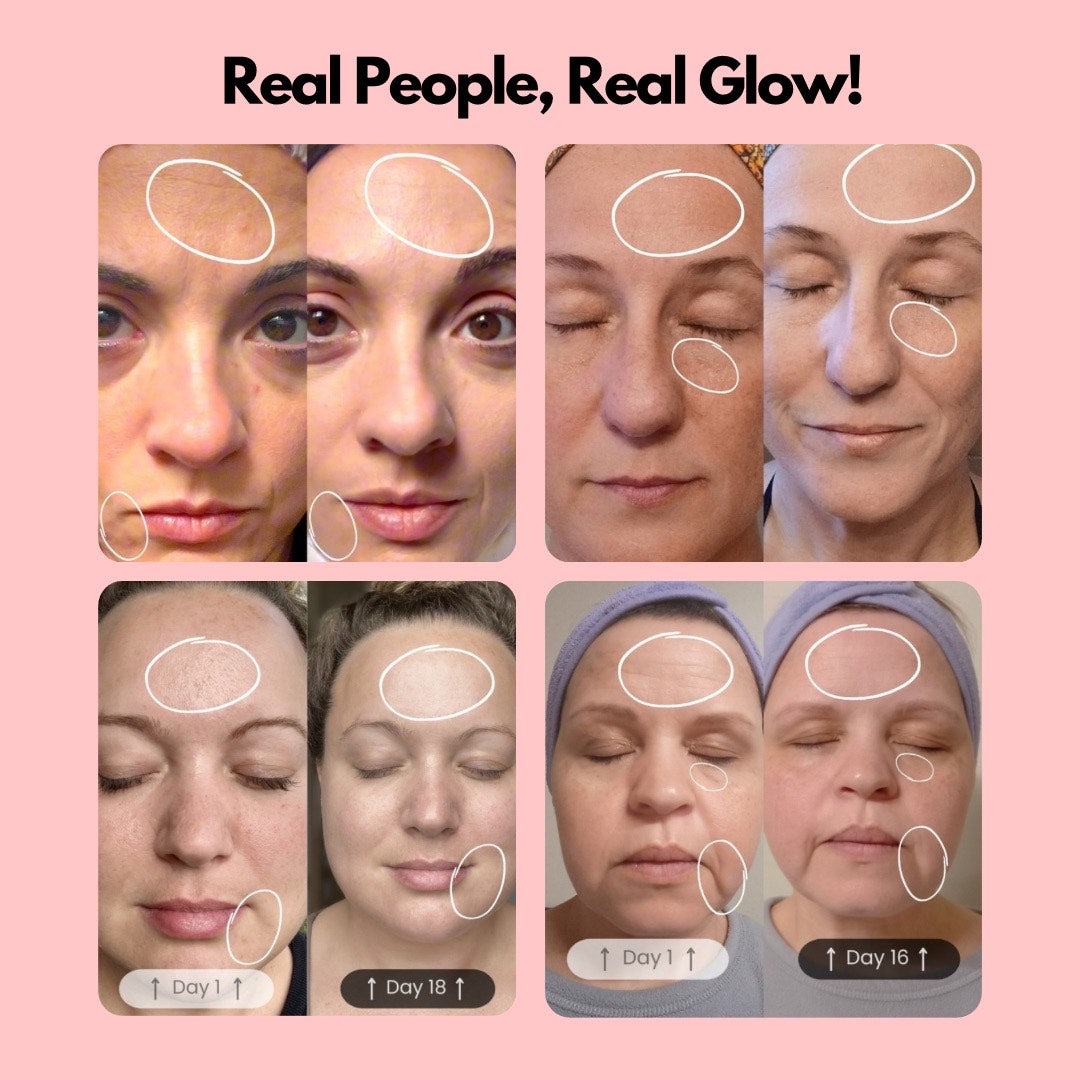 Healight™ Red Light 4-in-1 Skincare Wand